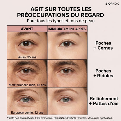 BIOPHOX EYE — Tenseur Regard Instantané